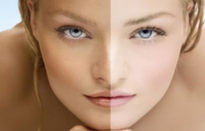 Solaryum göz yaralanmalarına da neden olabiliyor