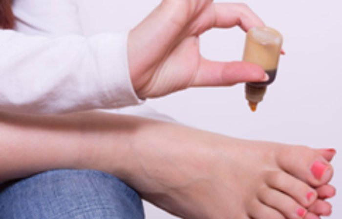 Dikkat! Vorikonazol Maddesi İçeren Mantar İlaçları Saç Dökülmesi Yapabilir