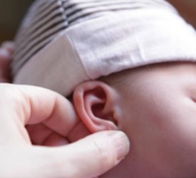 Yenidoğan Bebeklerde Kulak Şekil Bozukluklarını Düzelten Aparat Kullanımda