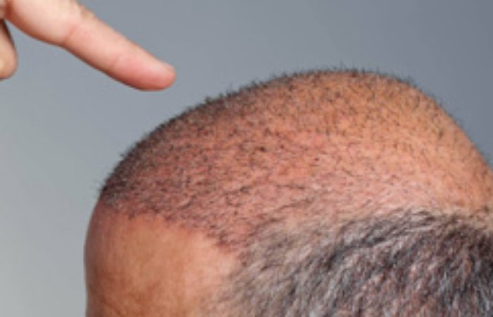 Trixowell Şampuanla Saçlarınız Daha Genç