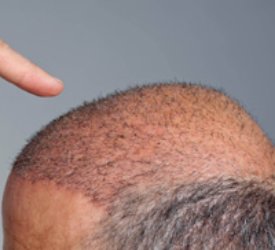 Trixowell Şampuanla Saçlarınız Daha Genç