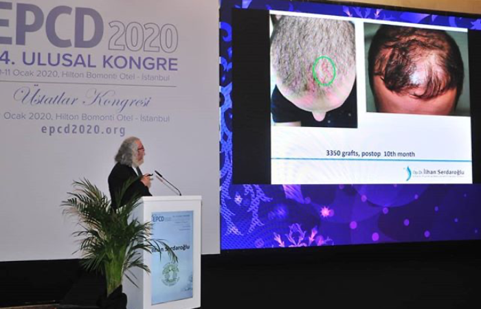 24. Ulusal Estetik Cerrahi Kongresi Sunumum 