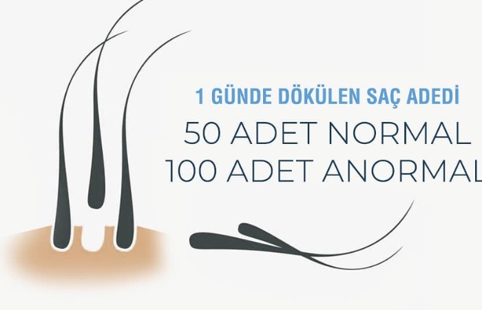 Günde 50 tel saç dökülmesi normal, 100 adet saç kaybı anormalmiş