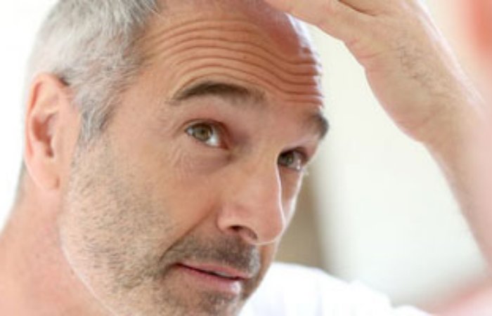 Artık saç kesmeden saç ekimi yapılabiliyor mu?