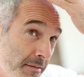 Artık saç kesmeden saç ekimi yapılabiliyor mu?