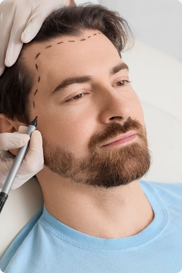 DHI TRAŞSIZ SAÇ EKİMİ