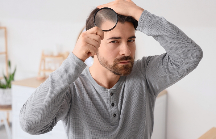 Genç Ve Ergende  Saç Kaybı Nedenleri Nelerdir