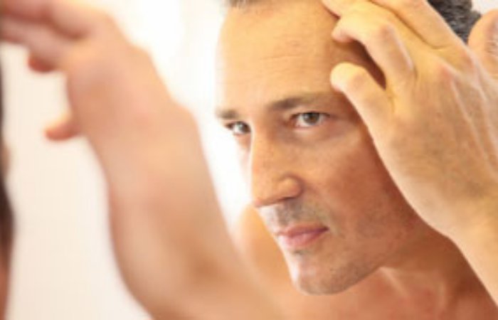 Hangi teknikle saçlarımızı ektirmeliyiz?