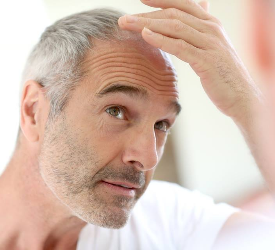 Her Yerde Saç Ektirilir mi?