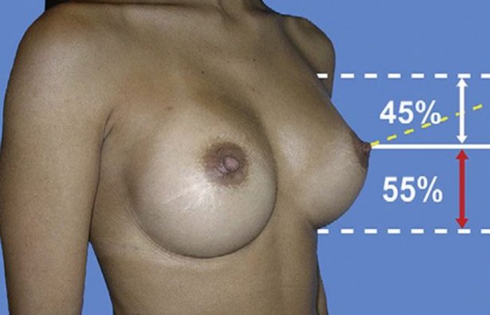 İdeal Meme Nasıl Olmalıdır? Ölçüleri Nelerdir?