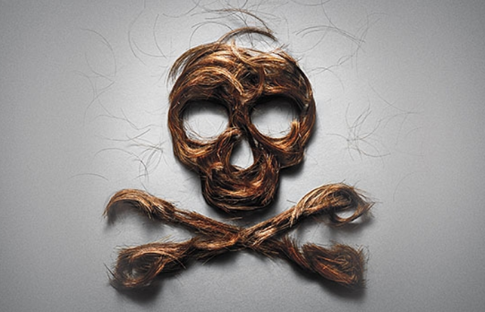 ISHRS Uyardı: Yasal olmayan saç ekimine dikkat 