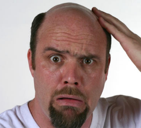 Koroner Kalp Hastalıkları Ve Kellik Arasında Bir İlişki Mi Var?