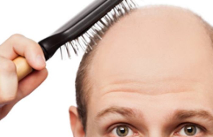 Saç Ekimi Kabus Olmasın