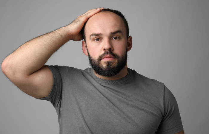 Saç Ekim Fiyatları 2025