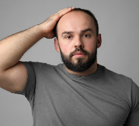 Saç Ekim Fiyatları 2025