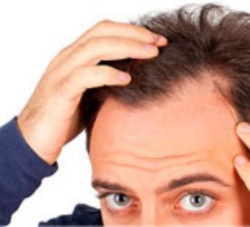 Saç ekimi ağrılı bir işlem midir?