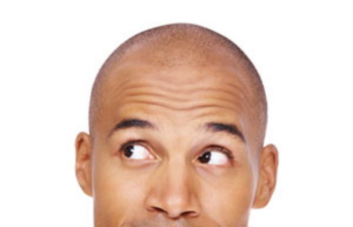 Saç ekimi yaptırdığım çok belli olur mu, normal görünüme ne zaman kavuşabiliriz?