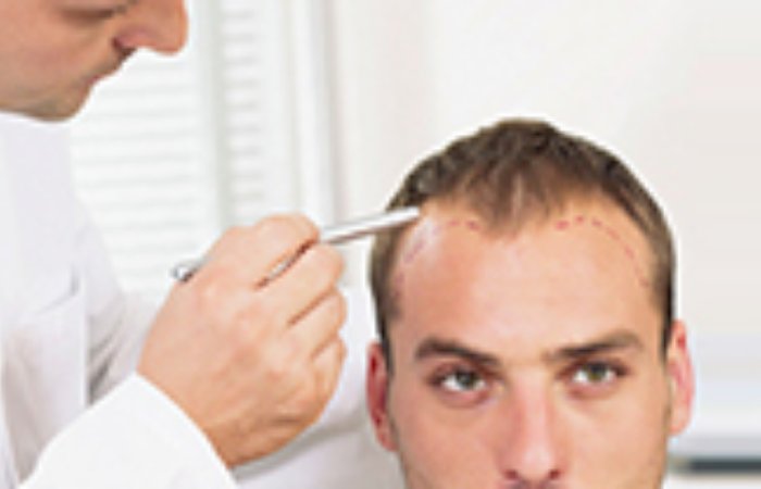 Saç Ekimini Nerede Yaptıralım?