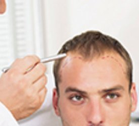 Saç Ekimini Nerede Yaptıralım?