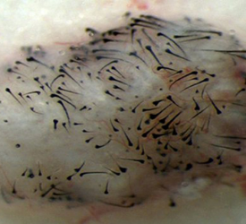 Saç Klonlamaya Yaklaştık mı? Saç Ekimi Tarihe mi Karışıyor?