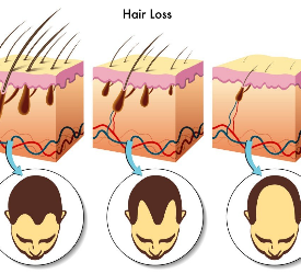 Saç Oto Klonlama Nedir? Saç Botoxu Nedir ? Saç Dolgusu Nedir ? İşe Yarar Mi? 