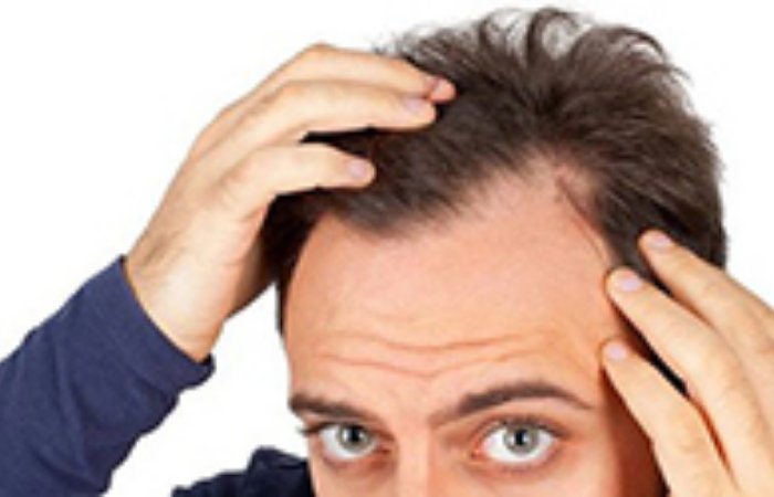 Saç Tedavilerinde Lazer Kullanılır mı?