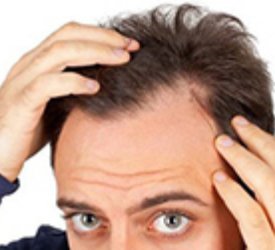 Saç Tedavilerinde Lazer Kullanılır mı?