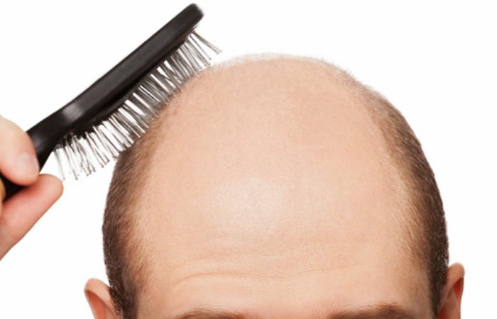 Şampuanıma  Doğum Kontrol Hapı Atarsam Saç Dökülmem Durur Mu?