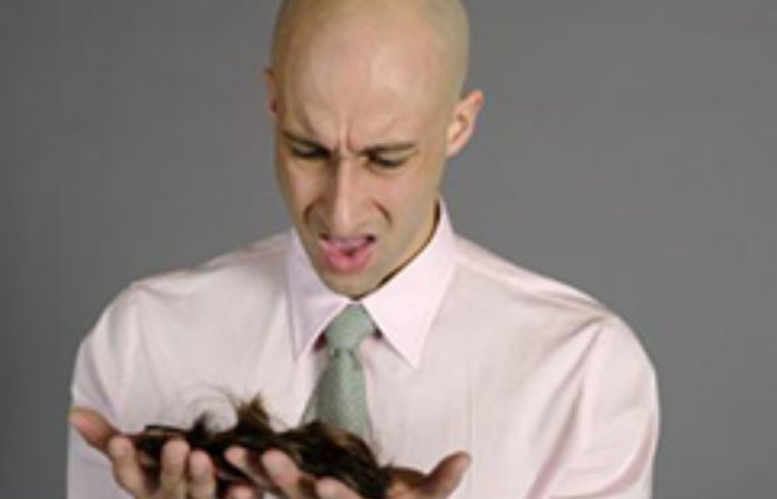 Stres Saç Döker mi?