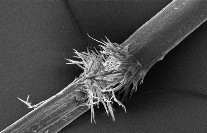 Trichorrhexis Nodosa Nedir?