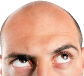 Vücut kıllarından saç ekimi yapılabilir mi?